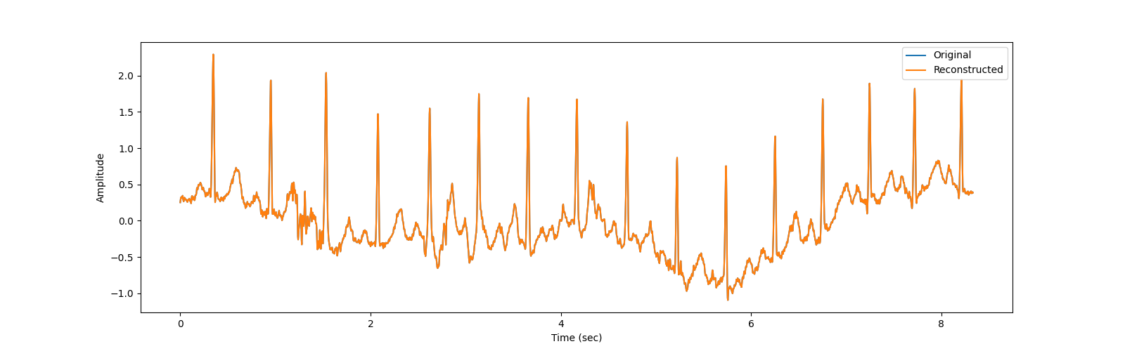 ecg compression